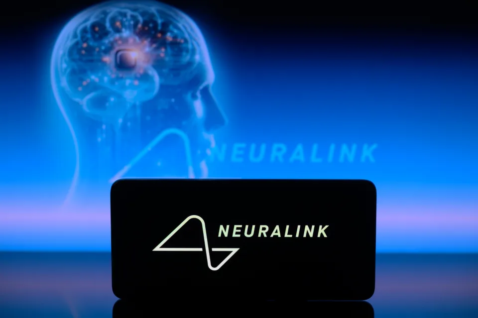 ویدیو از اولین بیمار انسانی Neuralink را مشاهده می کنید که با افکارش کامپیوتر را کنترل می کند